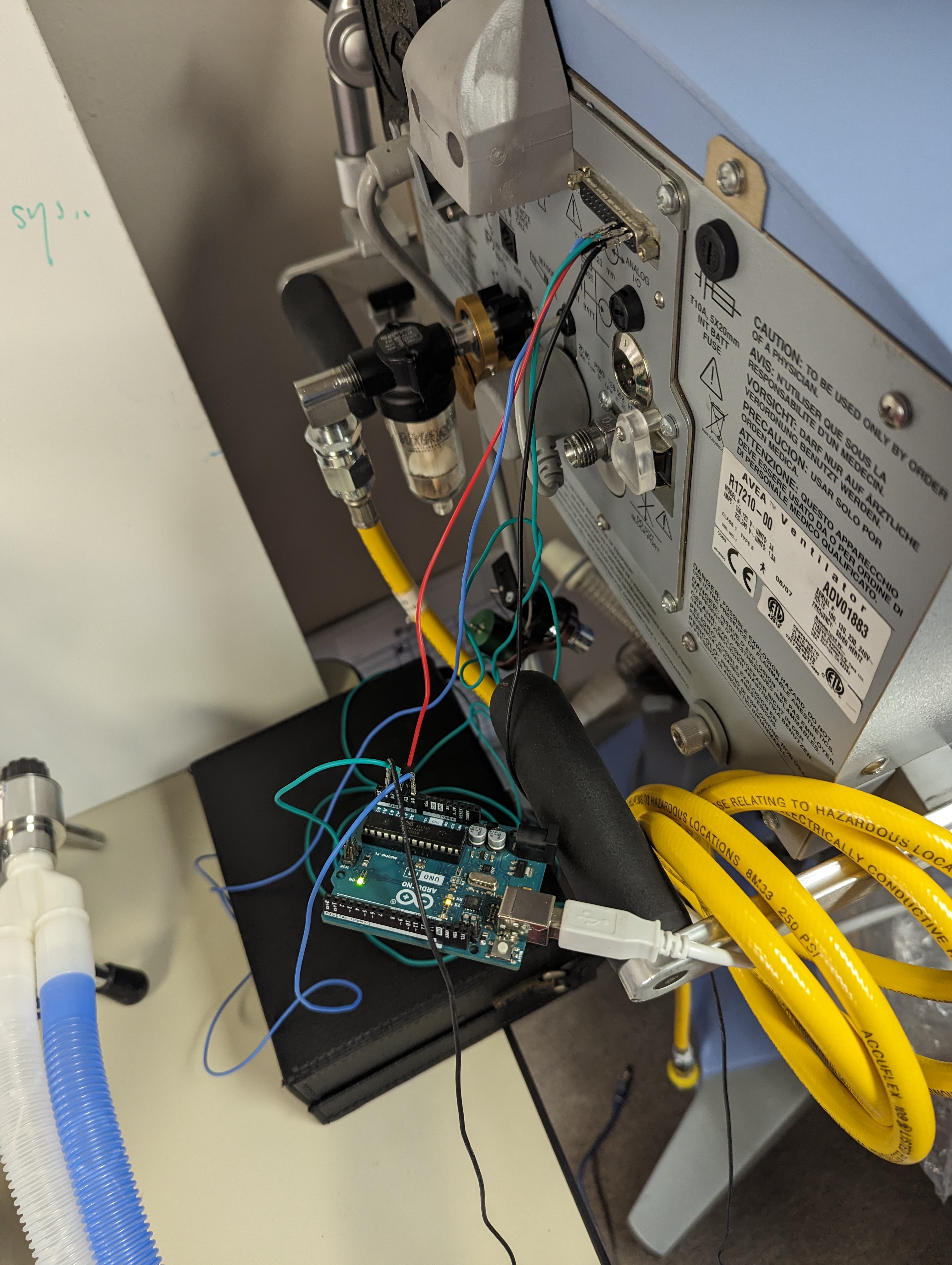 Ventilator to Arduino Connection