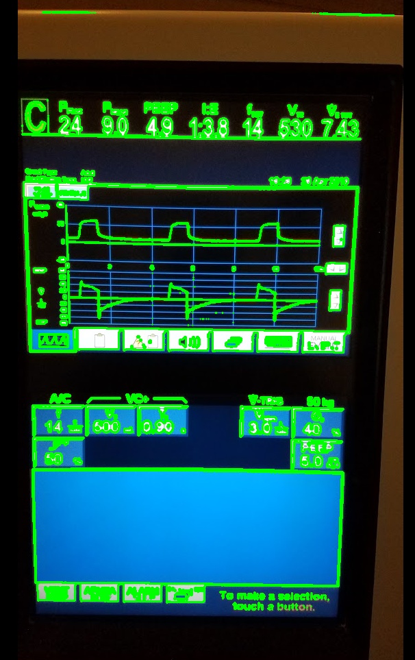 Ventilator screen display traced