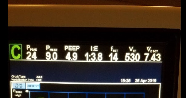 Ventilator screen display top section